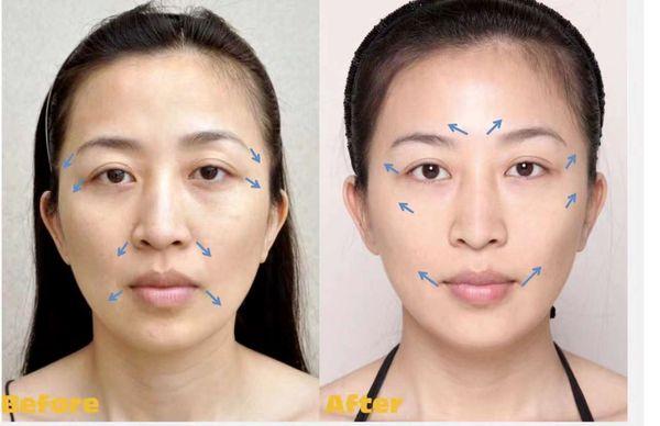 Face lifting!