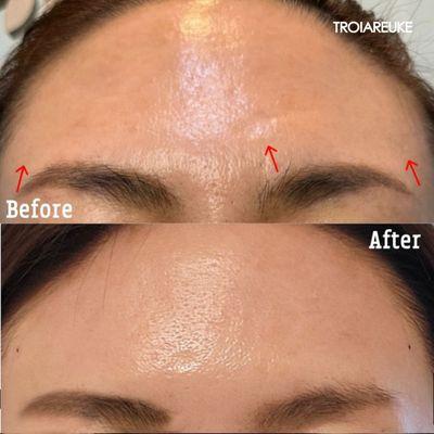 TROIAREUKE California | Buena Park, California | Skin Care