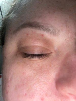 The eye brow threading was very painful and caused multiple abrasions on my eyelid.