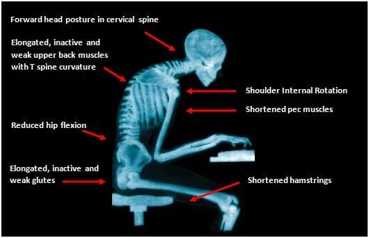 Posture pain can be a thing of the past!