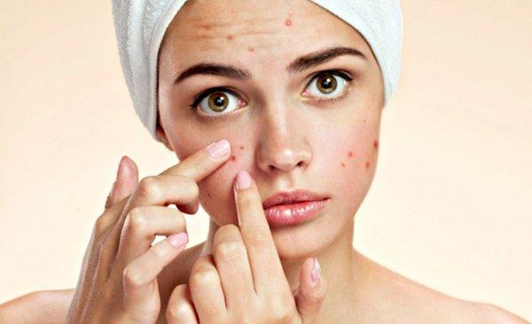 Orange Coast Dermatology Treats Acne