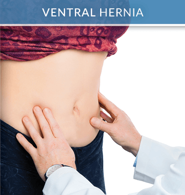 With his experience, Dr. Ara Keshishian has successfully treated a wide range of abdominal and groin area problems including ventral hernia