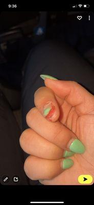 Nail ripped off from acrylic