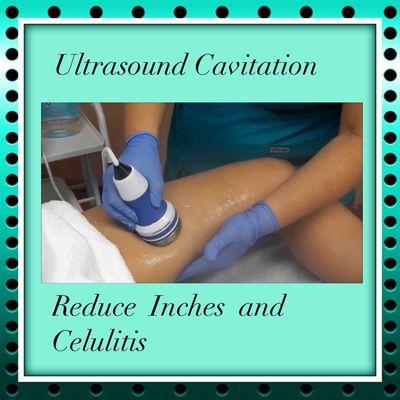 Ultrasonic Cavitation