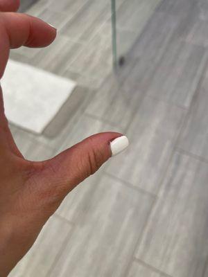 Cut on nail side due to bad filing