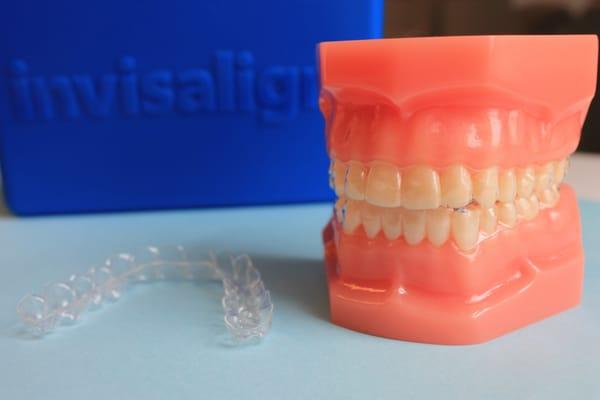 Looking to straighten out that smile? We are preferred Invisalign providers.