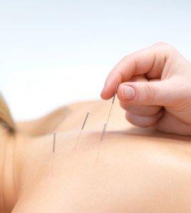 Dry needling and other therapies are utilized to help patients get back to moving and feeling well.