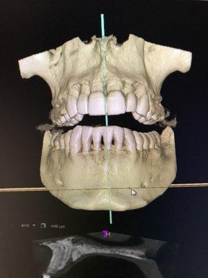 3-D imaging used at City Creek Dental for better diagnosis and treatment planning.