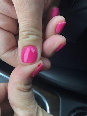 nail started bleeding after we left, faded dip job