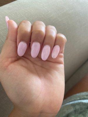 Horribly shaped "almond" nails