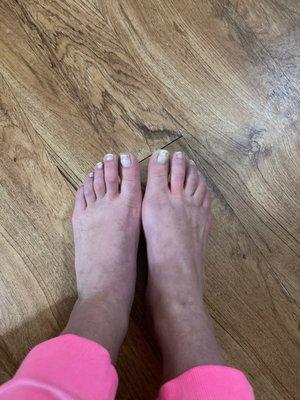 My torn up toe nails- This is how I left