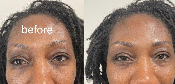 Dark skin microblading results