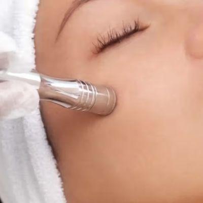 Microdermabrasion