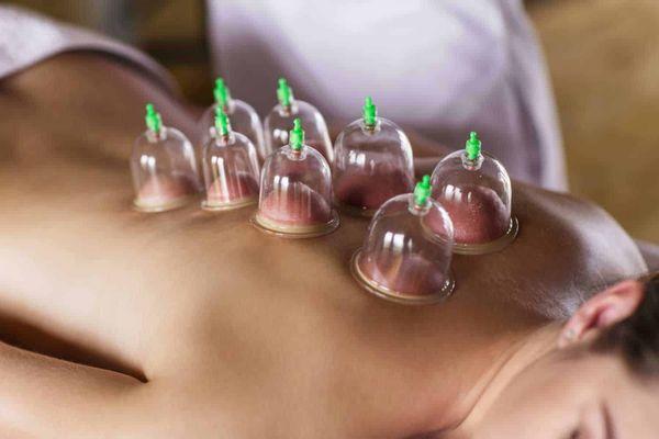 Cupping Massive