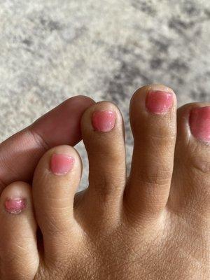 My 3rd toe had a small cut on the bottom left