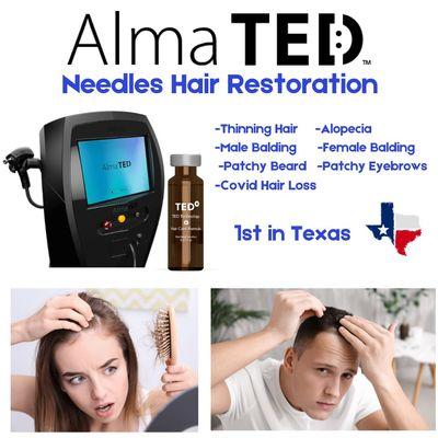 Hair Restoration- Pain Free- Latest Medical Treatment available