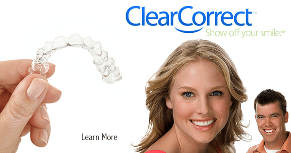 Clear aligner braces no need for traditional brackets. Just ask our friendly staff for a free consultation.