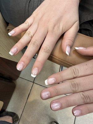 Terrible nails