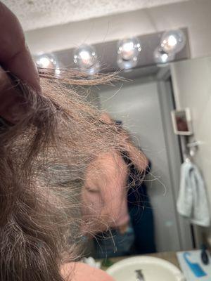 Example of "thinned hair."