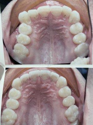 Before (top) vs after (bottom)