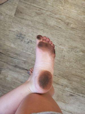 This is how dirty my feet were getting from walking on their hotel room floor..