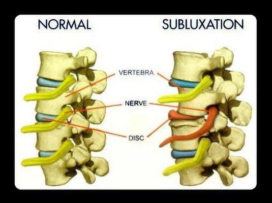 Chronic back pain can lead to more serious issues.  Don't wait, don't mask the pain with medications.  Get evaluated ASAP!