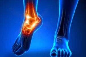 arthritis pain treatment