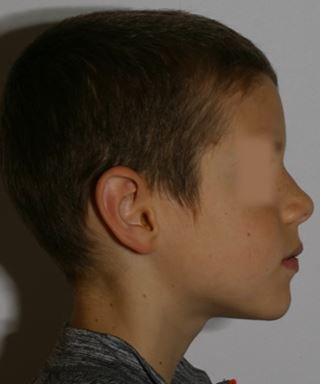 Age 10: Good Airway, Sound Sleeper, Correct Head Posture, Strong Lower Jaw, Good Stress Tolerance, No Bed Wetting