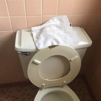 Cracked toilet seat, watch your skin!