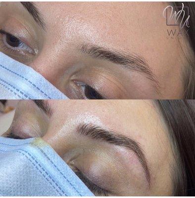 Microblading