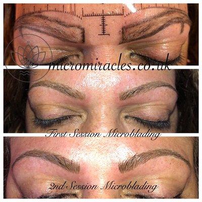 Microblading