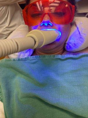 Teeth whitening