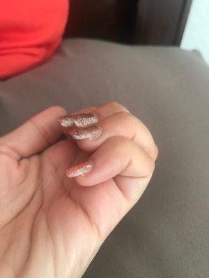 My brand NEW nails....look at what a disgusting job they did -_-. Cracking, gaps, no polish. I can't believe how bad this place is!!!!!