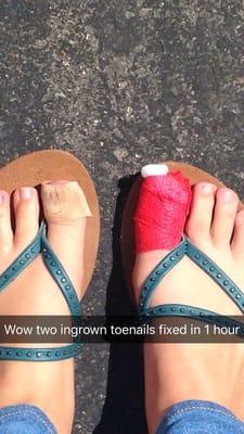 Dr. Noorda took care of my two ingrown toenails super quickly & with barely any pain!