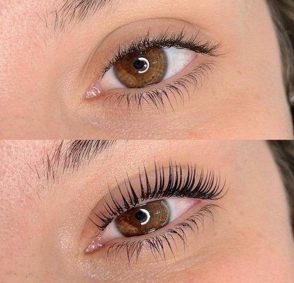 Eyelash lift