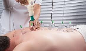 cupping therapy