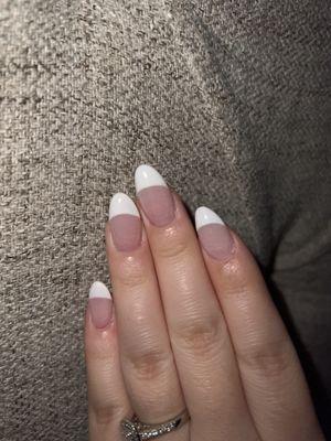 White lines in nails