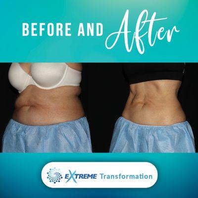 Extreme Transformation Program - Before and After