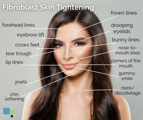 Fibroblast No Surgery Face Lift Long Lasting Results