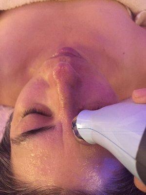 Micro current lifting facial treatment