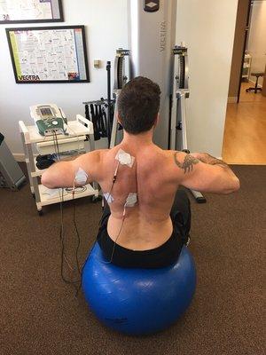 Neuromuscular electrical stimulation (NMES) being utilized to help re educate muscle specific weakness after nerve injury.