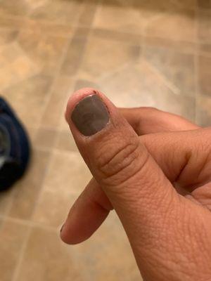 One of 3 fingers that where cut