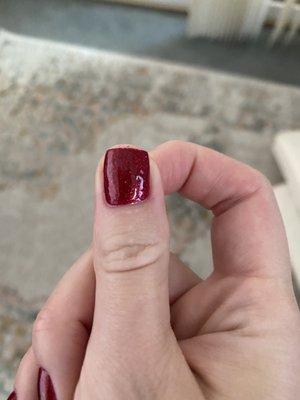 Visibly uneven nail