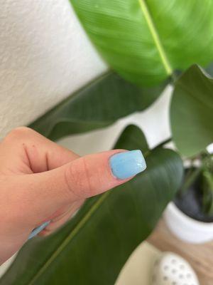 Chopped bottom thumb nail without polish