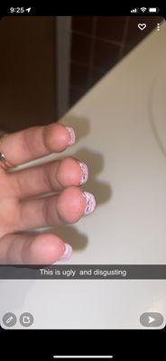 All my nails look like this not even cleaned up