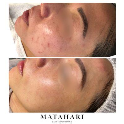 Matahari Skin Solutions