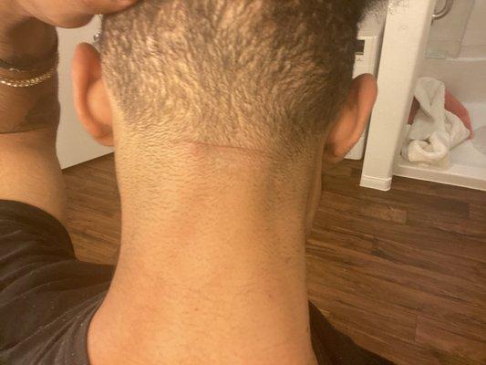 Barber Gashed my neck