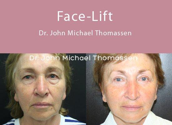 Fort Lauderdale Plastic Surgery by Dr. John Michael Thomassen - Board Certified Plastic Surgeon...