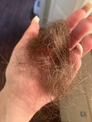 Hair falling out in 1 days worth. Coming out from back of head