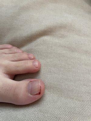 The toenail that she cut and left like nothing happened.